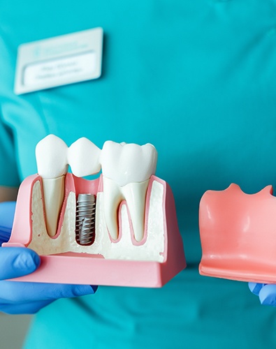 Dentist showing patient model tooth and dental implant supported dental crown