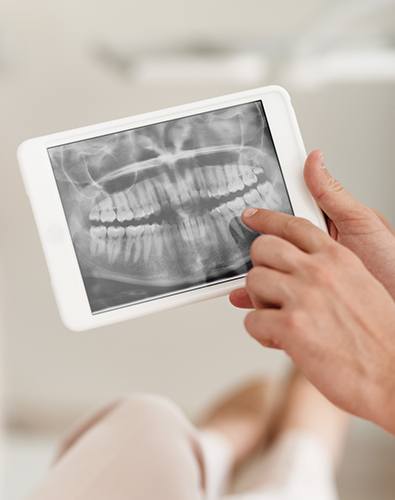 Digital x-rays on tablet computer