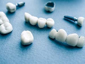 Different types of dental implants in Denton on blue background