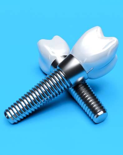 Closeup of dental implants in Denton on blue background