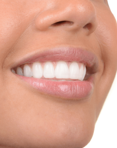 Closeup of healthy smile after preventive dentistry visit