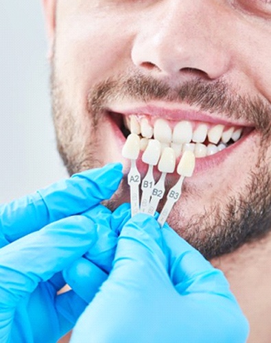 dentist holding several veneers up to a patient’s smile