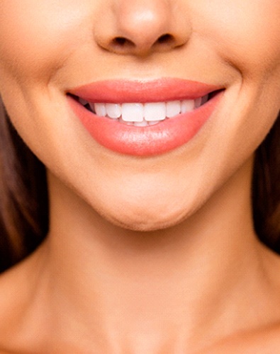 Closeup of woman smiling with veneers