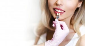 Closeup of a patient receiving porcelain veneers