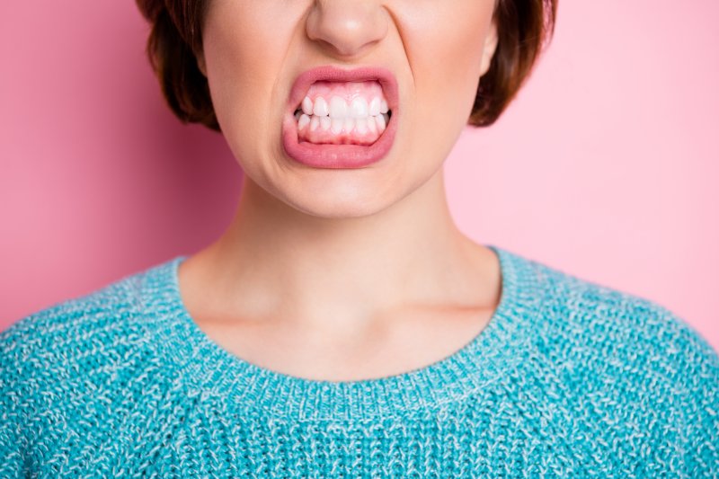 Woman grinding her teeth with dental implants